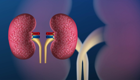Best Nephrologist in bangalore