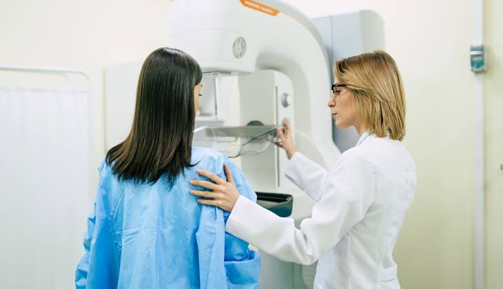 mammography systems